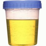 urine drug test