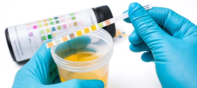pass urine test vinegar